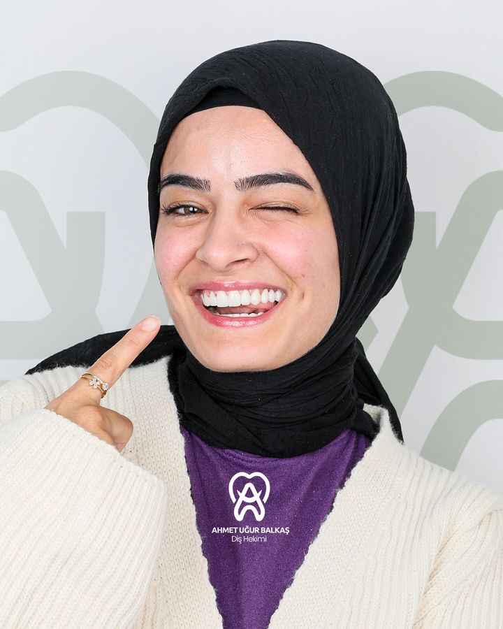Nazlıcan — gülüş tasarımı sonrası